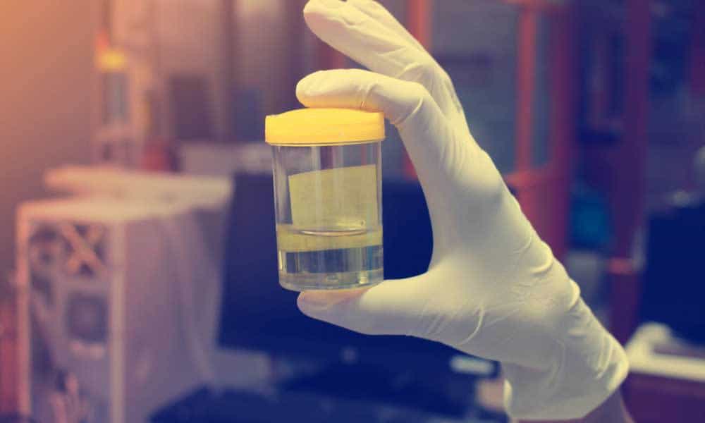 THC nelle urine: tutto quello che c’è da sapere
